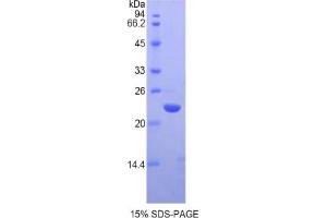 SDS-PAGE analysis of Human Chromobox Homolog 3 Protein. (CBX3 Protein)