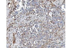 IHC analysis of EHD3 using anti-EHD3 antibody (ABIN7602777). (EHD3 antibody  (C-Term))