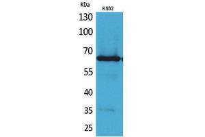 Western Blotting (WB) image for anti-Frizzled Family Receptor 10 (FZD10) (N-Term) antibody (ABIN3187803) (FZD10 antibody  (N-Term))