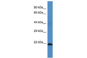 Host: Rabbit Target Name: MSRA Sample Type: HT1080 Whole Cell lysates Antibody Dilution: 1. (MSRA antibody  (Middle Region))