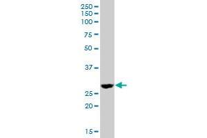 DHRS4 MaxPab polyclonal antibody. (DHRS4 antibody  (AA 1-278))