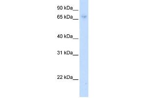 WB Suggested Anti-ZNF432 Antibody Titration:  0. (ZNF432 antibody  (C-Term))