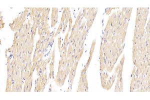 Detection of HMGCR in Rat Cardiac Muscle Tissue using Polyclonal Antibody to 3-Hydroxy-3-Methylglutaryl Coenzyme A Reductase (HMGCR) (HMGCR antibody  (AA 638-887))