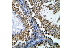 Immunohistochemical analysis of Topoisomerase 2 beta staining in human tonsil formalin fixed paraffin embedded tissue section. (TOP2B antibody  (N-Term))