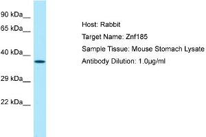 Host: Rabbit Target Name: Znf185 Sample Type: Mouse Stomach lysates Antibody Dilution: 1. (Zinc Finger Protein 185 antibody  (Middle Region))