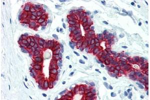 anti-pan Keratin (panKRT) antibody