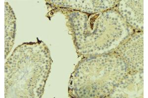 ABIN6275011 at 1/100 staining Mouse testis tissue by IHC-P. (CHPF antibody  (C-Term))