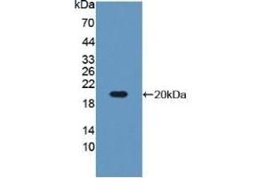 Detection of Recombinant IGFBP3, Mouse using Polyclonal Antibody to Insulin Like Growth Factor Binding Protein 3 (IGFBP3) (IGFBP3 antibody  (AA 152-292))