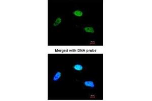 ICC/IF Image Immunofluorescence analysis of paraformaldehyde-fixed HeLa, using ZNF398, antibody at 1:200 dilution. (ZNF398 antibody)