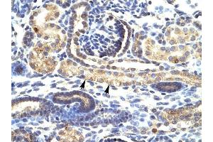 SNAI1 antibody was used for immunohistochemistry at a concentration of 4-8 ug/ml to stain Epithelial cells of renal tubule (arrows) in Human Kidney. (SNAIL antibody  (N-Term))