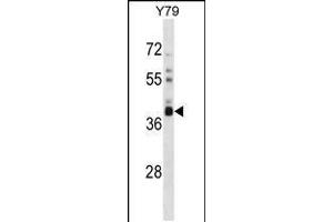 Western blot analysis in Y79 cell line lysates (35ug/lane). (OR52L1 antibody  (C-Term))