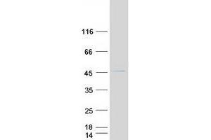 Validation with Western Blot