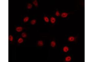 ABIN6266821 staining HuvEc by IF/ICC. (SUPT3H/SPT3 antibody  (Internal Region))