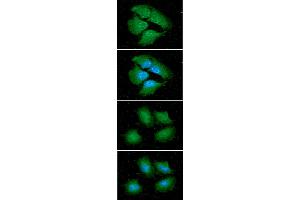 ICC/IF analysis of 14-3-3 epsilon in HeLa cells line, stained with DAPI (Blue) for nucleus staining and monoclonal anti-human 14-3-3 epsilon antibody (1:100) with goat anti-mouse IgG-Alexa fluor 488 conjugate (Green). (YWHAE antibody)