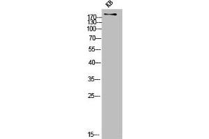 Western Blot analysis of KB cells using COL11A1 Polyclonal Antibody (COL11A1 antibody  (Internal Region))