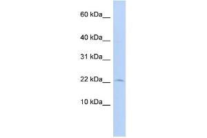WB Suggested Anti-FKBP2 Antibody Titration: 0. (FKBP2 antibody  (N-Term))