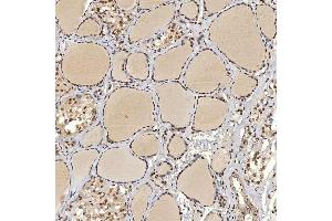 IHC analysis of U1A/SNRPA using anti-U1A/SNRPA antibody (ABIN7600891). (SNRPA1 antibody  (AA 25-218))