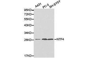 Western Blotting (WB) image for anti-Neurotrophin 4 (NTF4) antibody (ABIN1873969) (Neurotrophin 4 antibody)