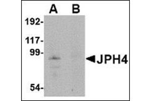 Western blot analysis of JPH4 in mouse brain tissue lysate with this product at 1 μg/ml in (A) the absence and (B) the presence of blocking peptide. (Junctophilin 4 antibody  (Middle Region))