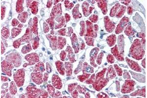 Human Heart: Formalin-Fixed, Paraffin-Embedded (FFPE) (GMP Synthase antibody  (AA 108-216))