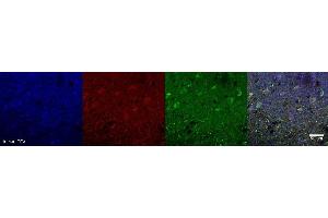 Immunohistochemistry (IHC) image for anti-Glutaminase (GLS) antibody (ABIN7456168) (Glutaminase antibody)