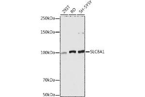Western blot analysis of extracts of various cell lines, using SLC8 antibody (ABIN6132664, ABIN6148050, ABIN6148052 and ABIN6221228) at 1:5000 dilution. (SLC8A1 antibody  (AA 250-520))