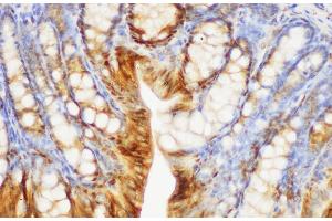 Immunohistochemistry of paraffin-embedded Mouse colon using S100A6 Polycloanl Antibody at dilution of 1:150 (S100A6 antibody)