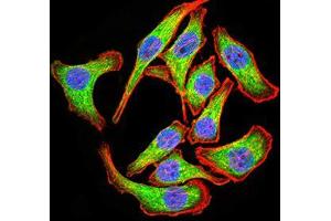 Immunocytochemistry (ICC) image for anti-PYD and CARD Domain Containing (PYCARD) (AA 1-120) antibody (ABIN5542580)