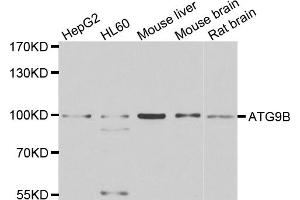 Western blot analysis of extracts of various cell lines, using ATG9B antibody (ABIN4902971) at 1:1000 dilution. (ATG9B antibody)