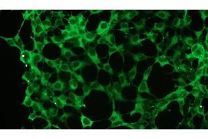 Immunocytochemistry (ICC) image for anti-Protein Kinase C, zeta (PRKCZ) antibody (ABIN870323) (PKC zeta antibody)