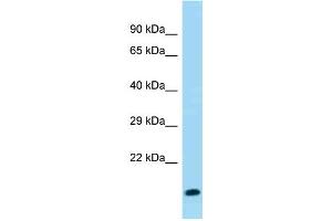 WB Suggested Anti-Gm8008 Antibody Titration: 1. (Gm8008 antibody  (C-Term))