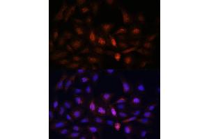 Immunofluorescence (IF) image for anti-Proteasome Subunit alpha  7 (PSMA7) (AA 1-248) antibody (ABIN1682332)