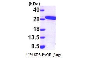 SDS-PAGE (SDS) image for Methylmalonic Aciduria (Cobalamin Deficiency) CblB Type (MMAB) (AA 33-250) protein (His tag) (ABIN667185)