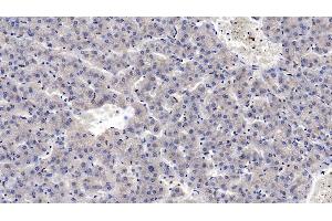Detection of MASP2 in Human Liver Tissue using Monoclonal Antibody to Mannose Associated Serine Protease 2 (MASP2) (Mannose Associated Serine Protease 2 (AA 170-287) antibody)