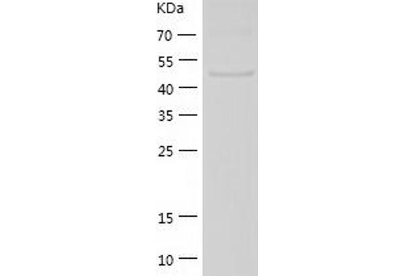EDIL3 Protein (AA 16-470) (His tag)