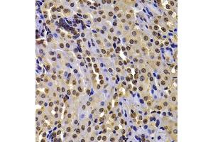 Immunohistochemistry of paraffin-embedded mouse kidney using WHSC1 antibody (ABIN6128925, ABIN6150213, ABIN6150214 and ABIN6223939) at dilution of 1:100 (40x lens).