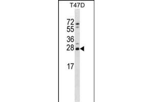 ZT2 Antibody (C-term) (ABIN656733 and ABIN2845957) western blot analysis in T47D cell line lysates (35 μg/lane). (ZMAT2 antibody  (C-Term))