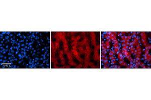 Rabbit Anti-PAntibody    Formalin Fixed Paraffin Embedded Tissue: Human Adult liver  Observed Staining: Cytoplasmic Primary Antibody Concentration: 1:100 Secondary Antibody: Donkey anti-Rabbit-Cy2/3 Secondary Antibody Concentration: 1:200 Magnification: 20X Exposure Time: 0.