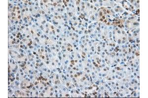 Immunohistochemical staining of paraffin-embedded Human Kidney tissue using anti-PFN1 mouse monoclonal antibody. (PFN1 antibody)