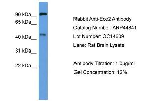WB Suggested Anti-Ece2  Antibody Titration: 0. (ECE2 antibody  (Middle Region))
