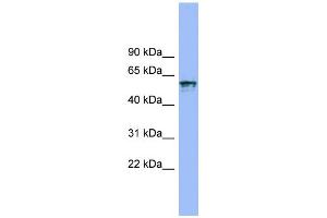 WB Suggested Anti-IL18R1 Antibody Titration:  0.