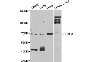 Western blot analysis of extracts of various cell lines, using PRKD3 antibody (ABIN5974259) at 1/1000 dilution. (PRKD3 antibody)
