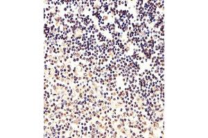 Immunohistochemical analysis of paraffin-embedded H. (FOXP1 antibody  (C-Term))