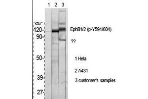Western Blot (WB) analysis of specific cells using Phospho-EphB1/2 (Y594/604) Polyclonal Antibody.