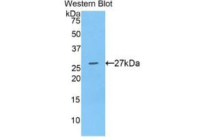 Western blot analysis of the recombinant protein. (ADAM10 antibody  (AA 218-445))