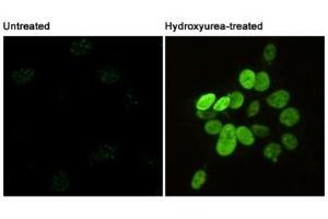 Immunofluorescent analysis of Phosphorylation of H2A. (H2AFX antibody  (pSer139))