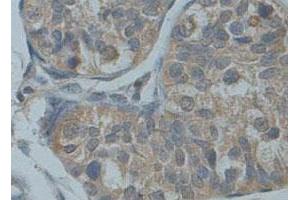 Immunohistochemical staining of formalin-fixed paraffin-embedded human fetal testis tissue showing membrane staining with ADAM30 polyclonal antibody  at 1 : 100 dilution.