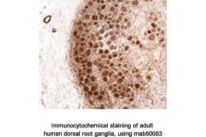 Image no. 2 for anti-Neurofibromin 1 (NF1) (N-Term) antibody (ABIN363207) (Neurofibromin 1 antibody  (N-Term))