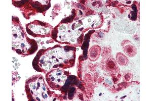 Anti-FERMT1 antibody IHC of human placenta. (FERMT1 antibody  (AA 643-660))