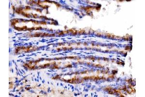 IHC analysis of AGPAT2 using anti-AGPAT2 antibody (ABIN7602435). (AGPAT2 antibody  (AA 77-178))